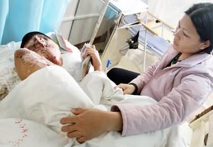 三亚一男孩爬电线杆时触电,严重烧伤遭截肢